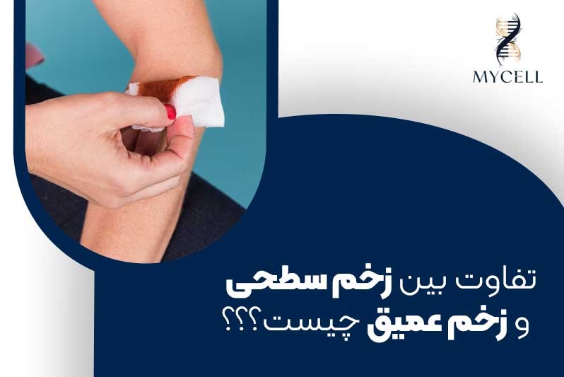 تفاوت بین زخم سطحی و زخم عمیق چیست و چطور درمان می‌شوند؟