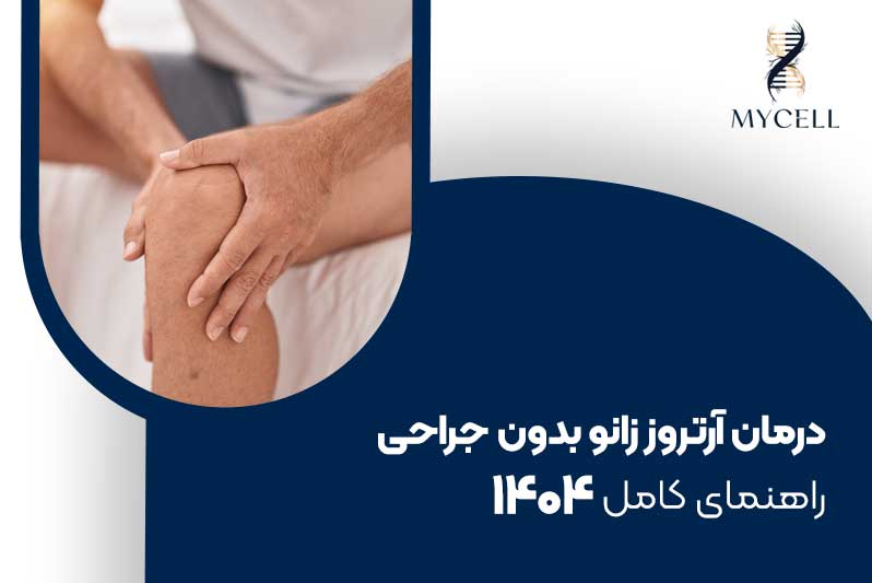 درمان آرتروز زانو بدون جراحی: راهنمای کامل ۱۴۰۴
